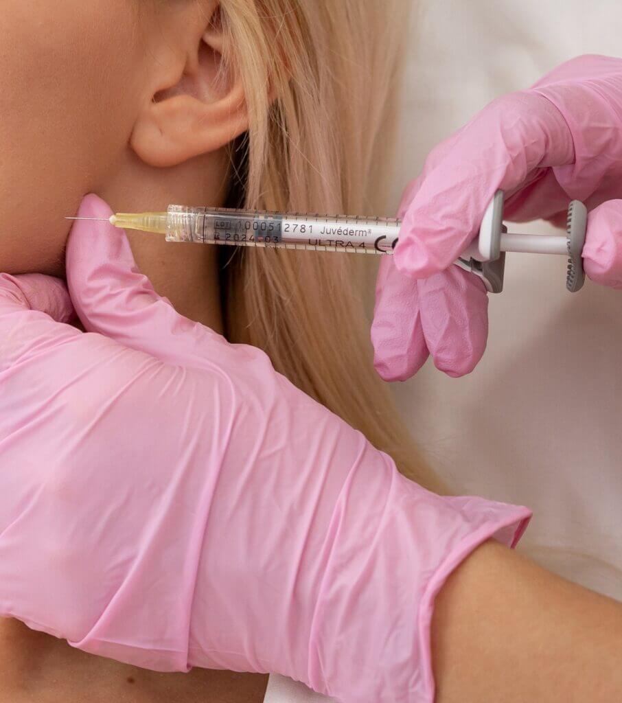 Marcación mandibular con ácido hialurónico