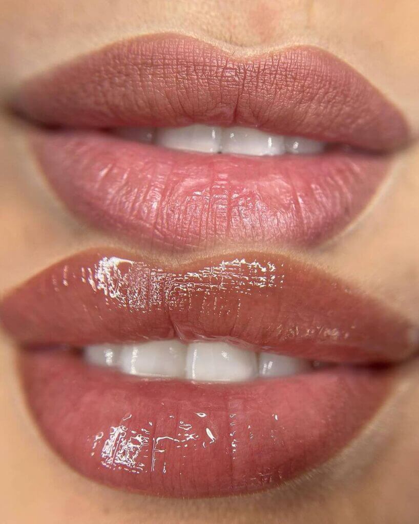 Micropigmentación de labios: comparativa frontal de los labios con un acabado de color cálido y brillante.