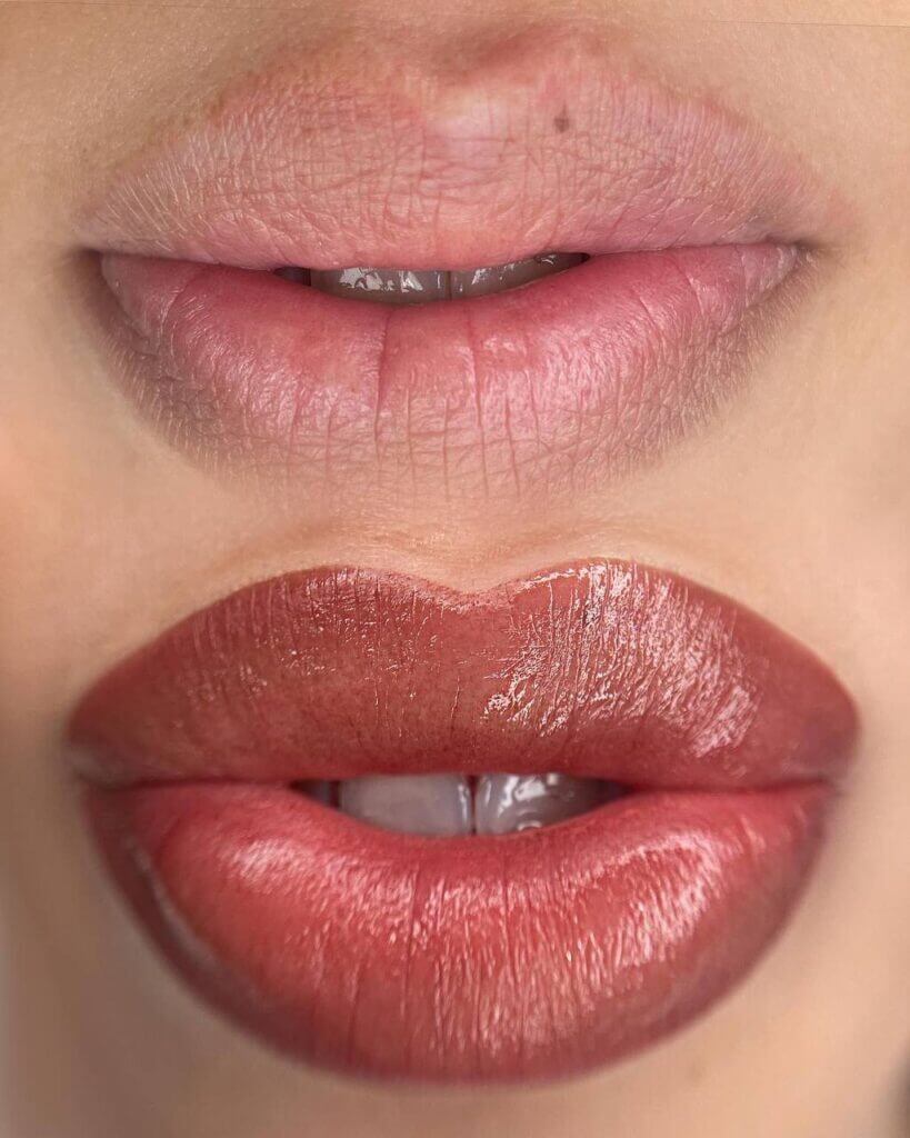 Micropigmentación de labios: comparativa del color de los labios, con un acabado rojizo y brillante.