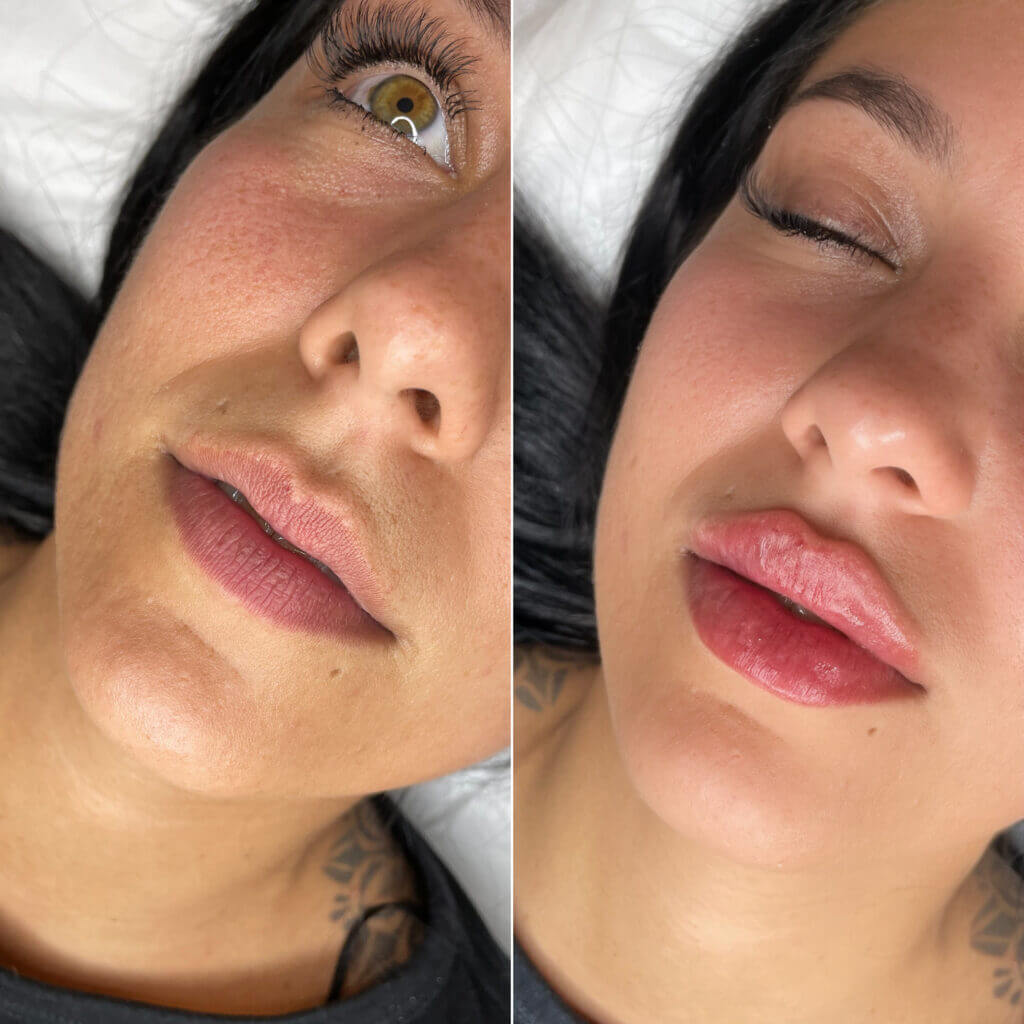 Comparativa de los labios en dos primeros planos del rostro inclinado.