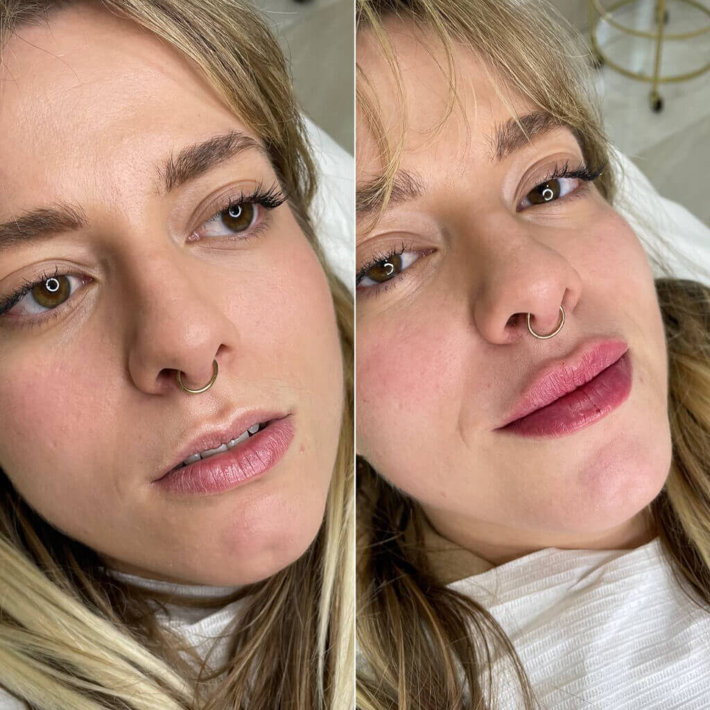 Comparativa frontal de los labios con distinta intensidad de color.
