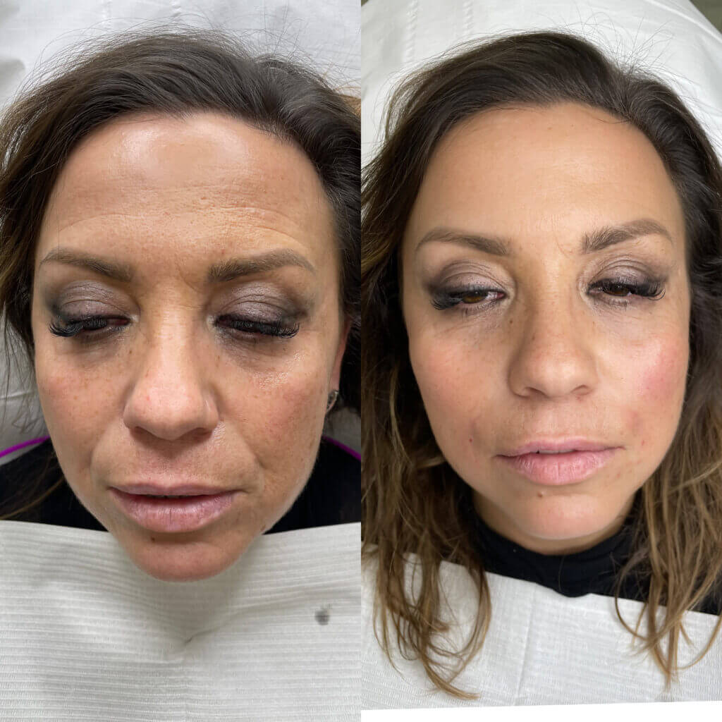 Rostro más joven y con contornos uniformes
