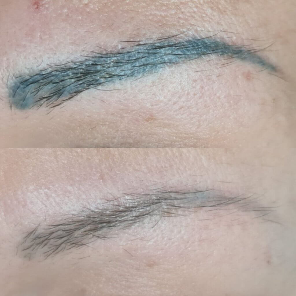 Micropigmentación antes y después