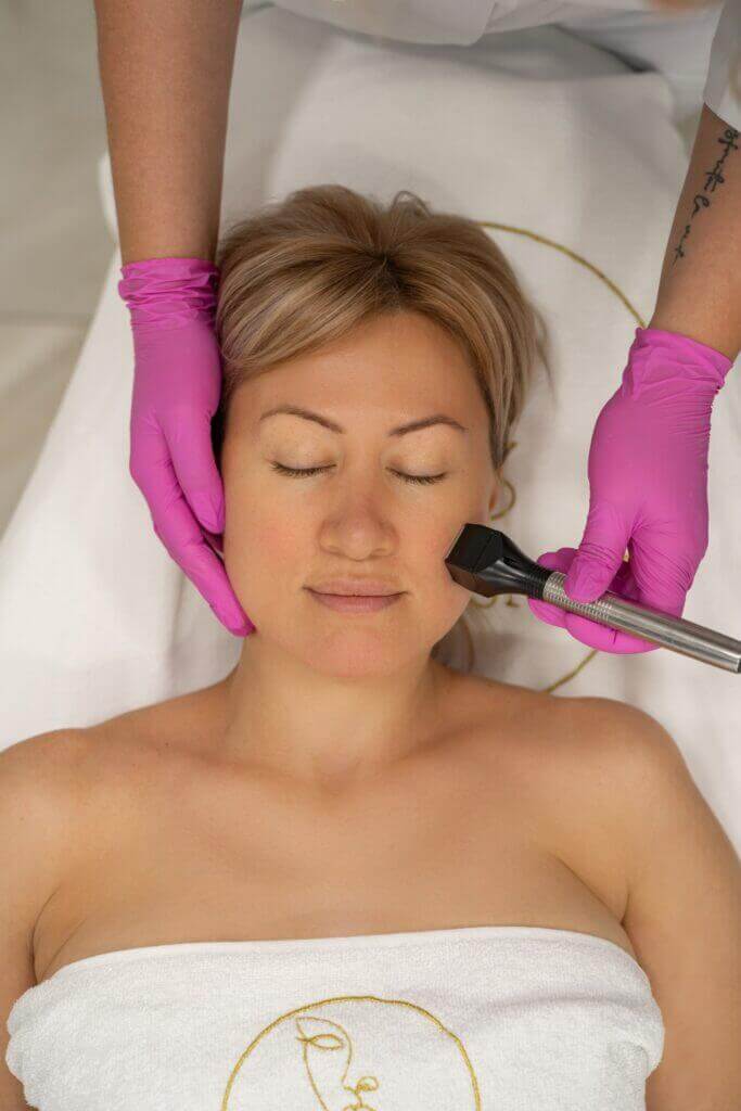 Tratamiento IPL