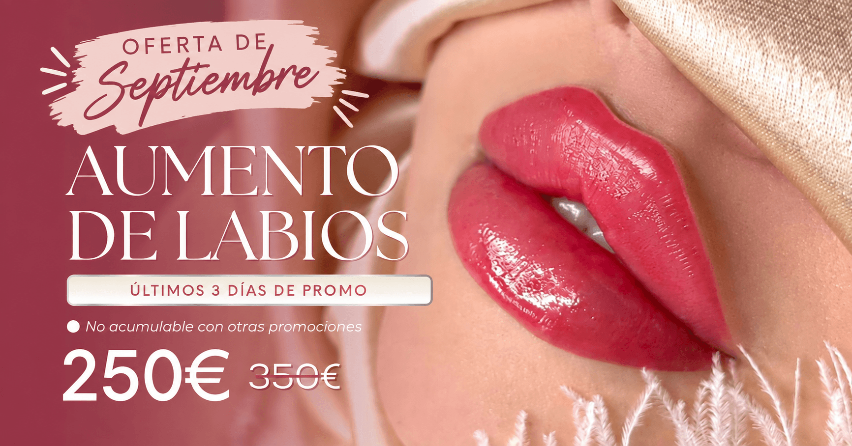 Gran oferta de aumento de labios en Madrid y Barcelona para Septiembre
